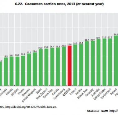 W których krajach najwięcej dzieci przychodzi na świat przez cesarskie cięcie.