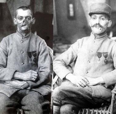 Francuski weteran I wojny bez i z maską autorstwa Anny Coleman Watts Ladd (Paryż)