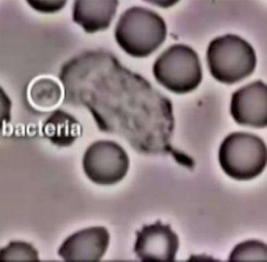 Krwinka biała (leukocyt) poluje na bakterię (Gronkowca złocistego, łac. Staphylococcus aureus)