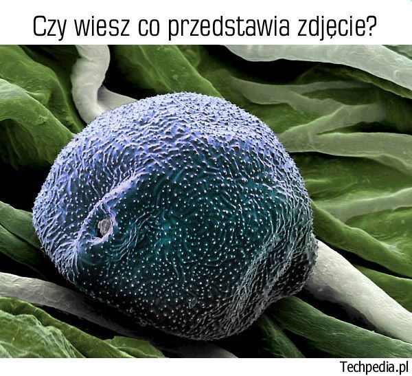 Co znajduje się pod mikroskopem elektronowym?