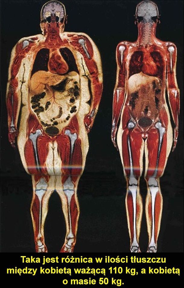 Różnica tłuszczu między kobietą ważącą 110 kg, a kobietą o masie 50 kg