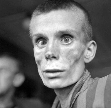 18-letnia Rosjanka uwolniona z niemieckiego obozu koncentracyjnego Dachau, 1945