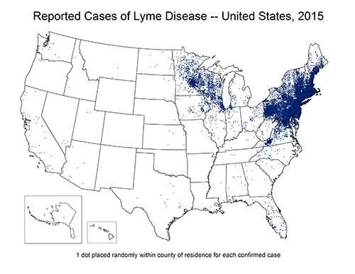 Mapa występowania przypadków boreliozy w USA (dane 2015)