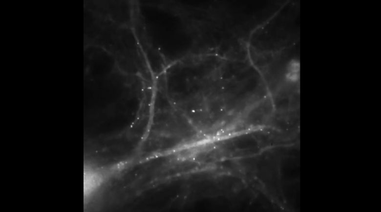Poprzez śledzenie mRNA w komórkach mózgu, naukowcy uchwycili mózg wytwarzający wspomnienia (wideo)