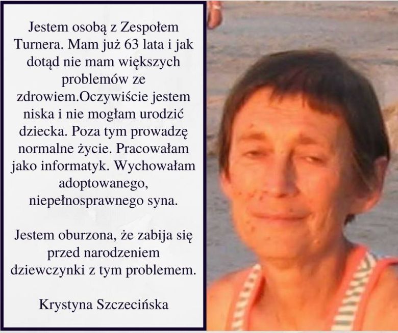 Ważny głos w dyskusji - osoba z zespołem Turnera