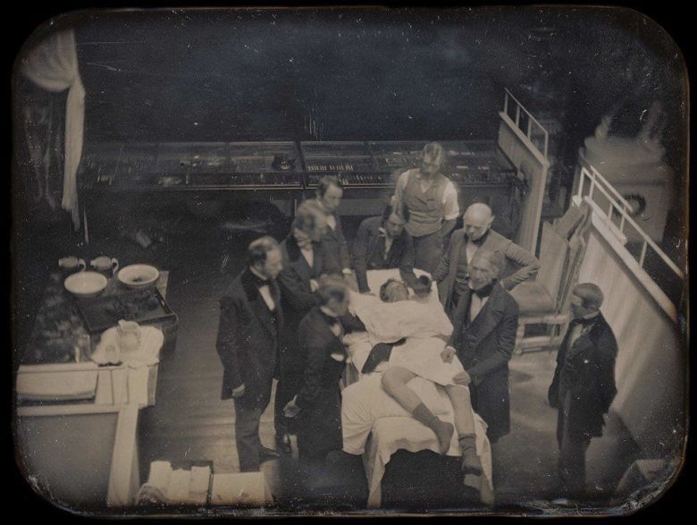 Pierwsza fotograficzna dokumentacja rzeczywistego przebiegu operacji medycznej, 1847