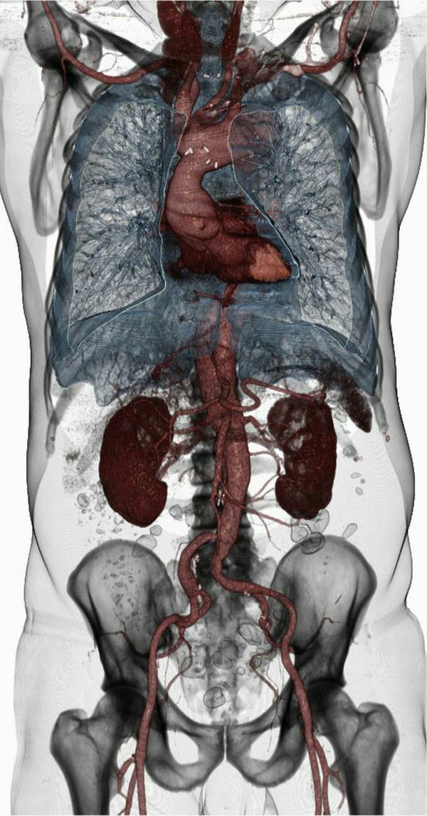 Tomografia komputerowa (TK) ludzkiego ciała