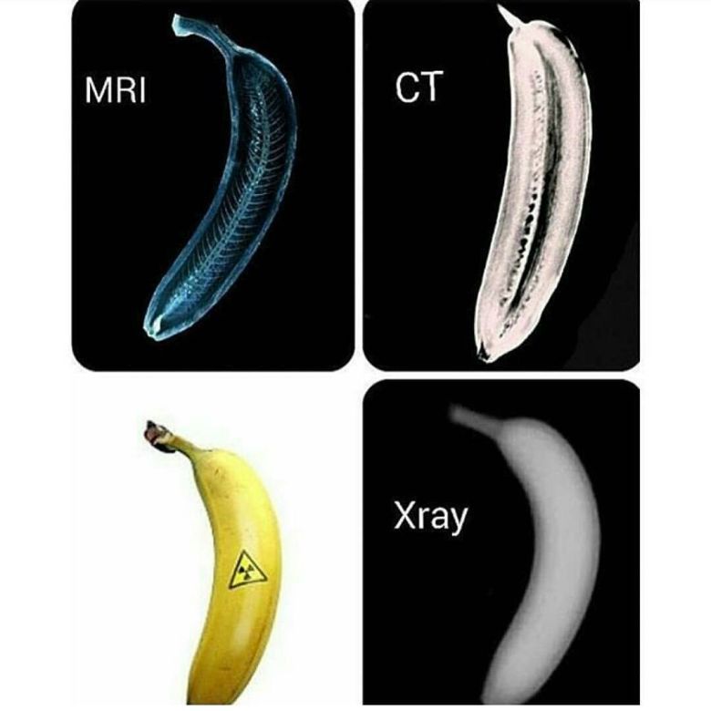 Banan na zdjęciu z rezonansu magnetycznego (MRI), tomografii komputerowej (CT) i promieniowania rentgenowskiego (Xray)