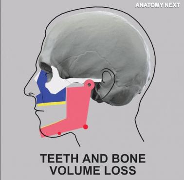 Co się dzieje z żuchwą człowieka po stracie zębów (animacja)