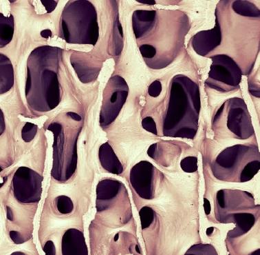 Ludzka kość pod mikroskopem elektronowym
