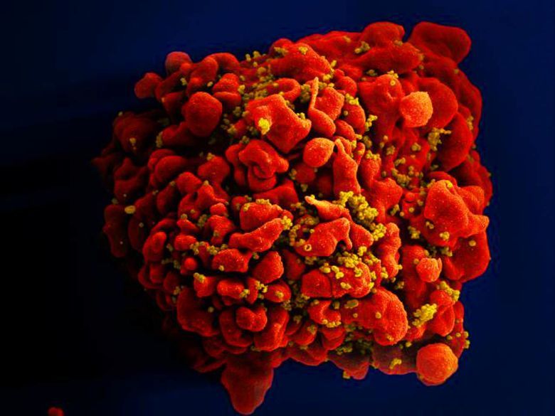 Wirus HIV/AIDS (żółty) atakuje ludzką komórkę układu odpornościowego (limfocyt T) (czerwony)