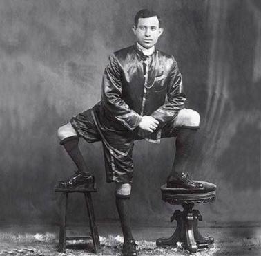 Frank Lentini, posiadacz 3 nóg, 4 stóp, 16 palców i 2 funkcjonujące zestawy genitaliów, 1884-1966