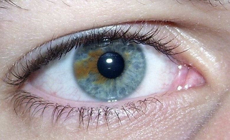 Różnobarwność tęczówki (łac. heterochromia iridis) dotyczy zaledwie 1 proc. populacji ludzi