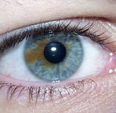 Różnobarwność tęczówki (łac. heterochromia iridis) dotyczy zaledwie 1 proc. populacji ludzi