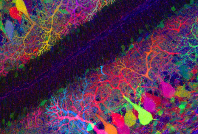 Obrazy mózgu genetycznie zmodyfikowanej myszy tak, aby zawierały neurony fluorescencyjne