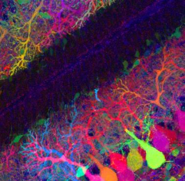 Obrazy mózgu genetycznie zmodyfikowanej myszy tak, aby zawierały neurony fluorescencyjne