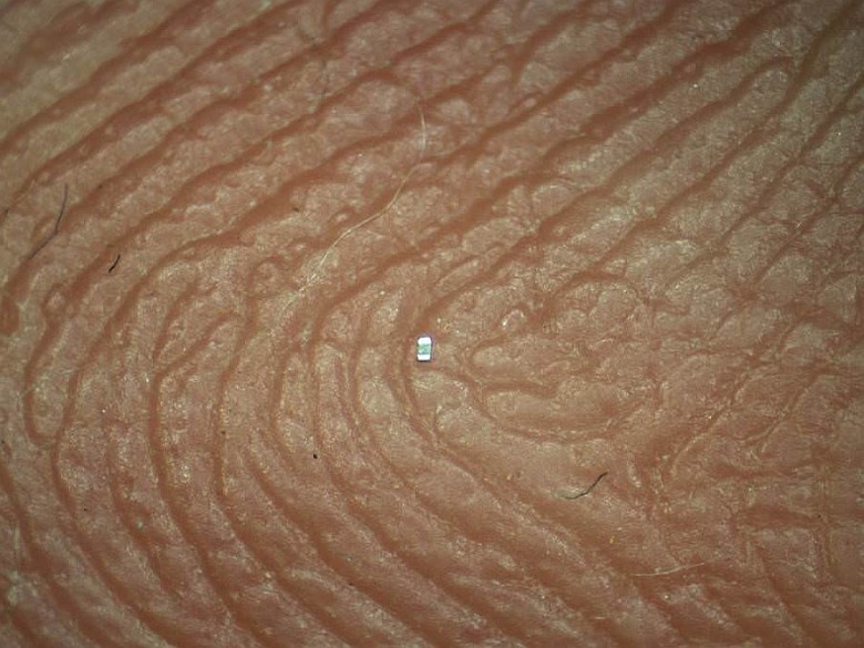 Kondensator o rozmiarze 008004 (0,25 x 0,125 mm) na czubku palca