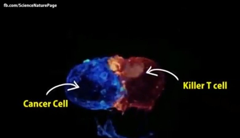 Limfocyt T atakuje komórkę nowotworową (wideo)