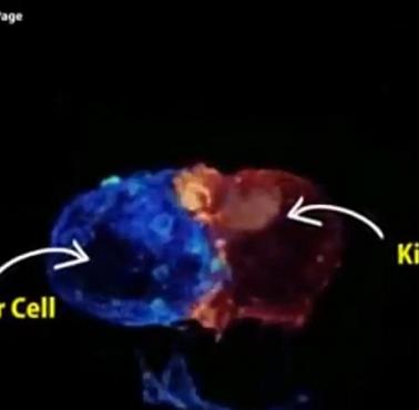 Limfocyt T atakuje komórkę nowotworową (wideo)
