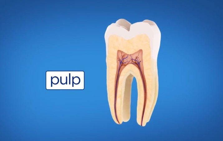 Jak wygląda kanałowe leczenie zęba (animacja HD)