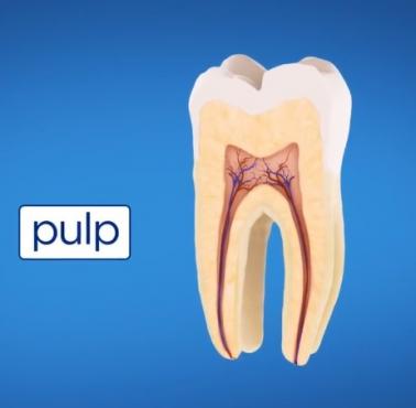 Jak wygląda kanałowe leczenie zęba (animacja HD)