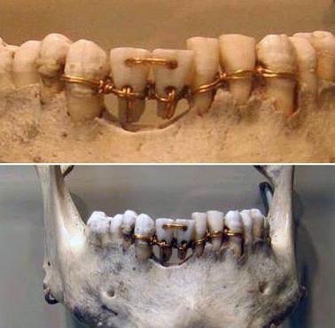 Praca starożytnych egipskich dentystów. Szacowany wiek na 2000 rok p.n.e.
