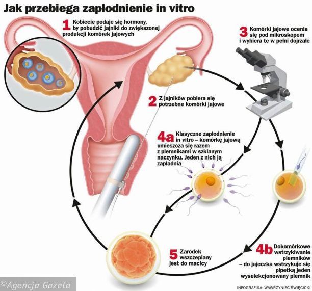 Czy dzieci in vitro są słabsze?