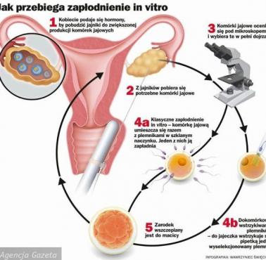 Czy dzieci in vitro są słabsze?