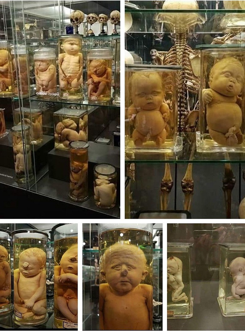 Kolekcja wad genetycznych w muzeum anatomicznym i embriologicznym Uniwersytetu w Amsterdamie