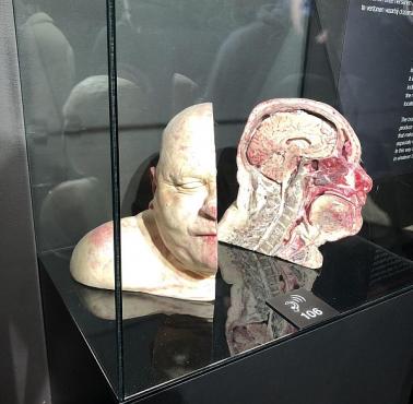Przekrój ludzkiej głowy