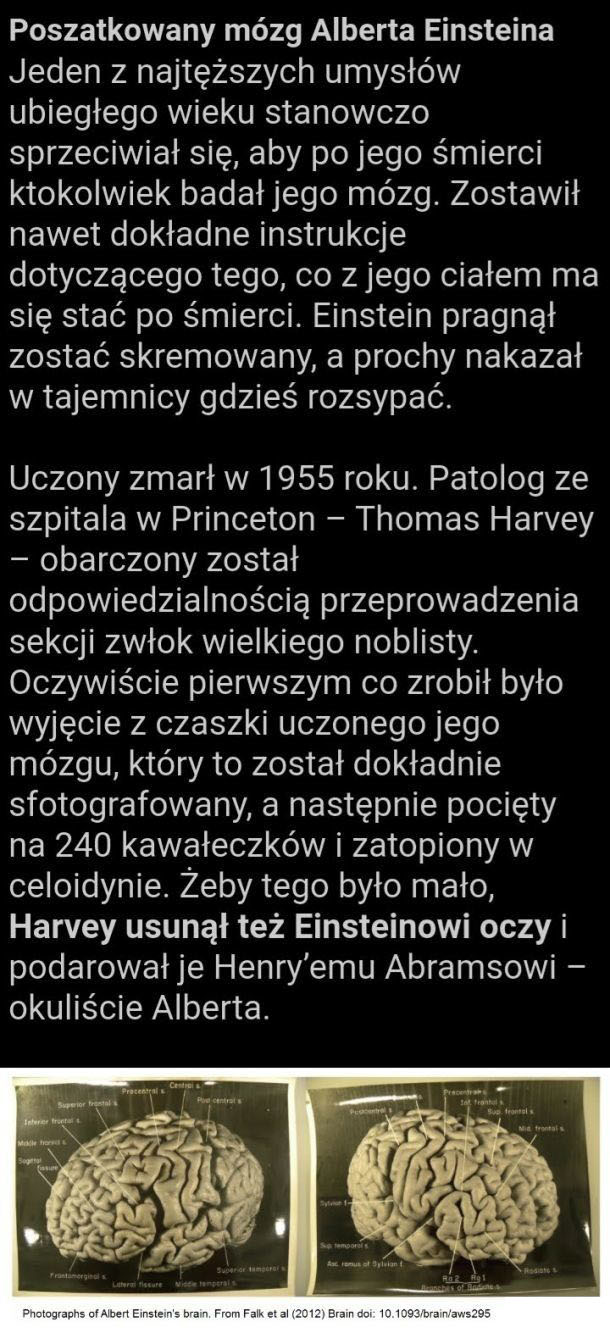 Co się stało z mózgiem Einsteina?