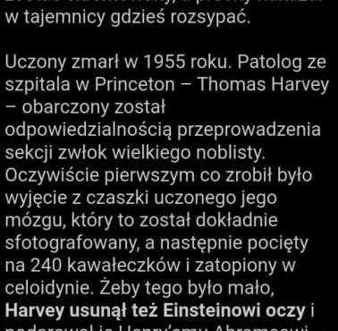 Co się stało z mózgiem Einsteina?