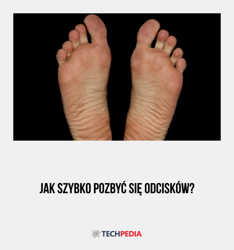 Jak szybko pozbyć się odcisków?