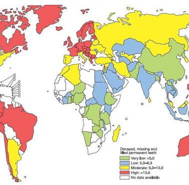 Występowanie ubytków w zębach według kraju.