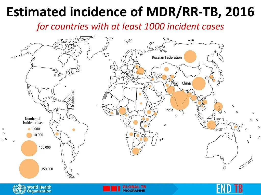 Liczba przypadków gruźlicy wielolekoopornej, 2017, WHO