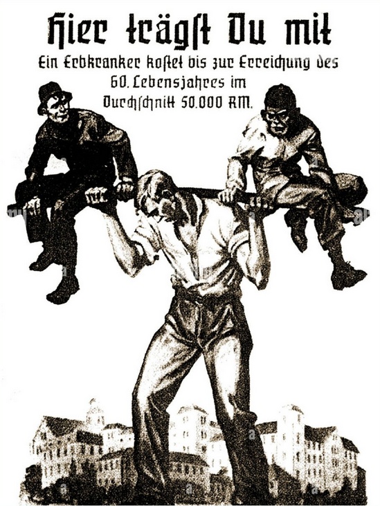 Niemiecki plakat eugeniczny (eutanazja) z czasów III Rzeszy Ich ciężar dźwigasz i ty. ...