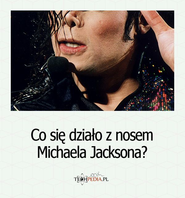 Co się działo z nosem Michaela Jacksona?