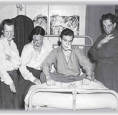 Lata 1941-45 - ofiary poparzeń z II wojny światowej po rekonstrukcji twarzy.